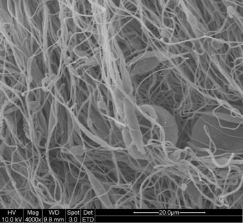 electrospun structure mimicking aortic valve