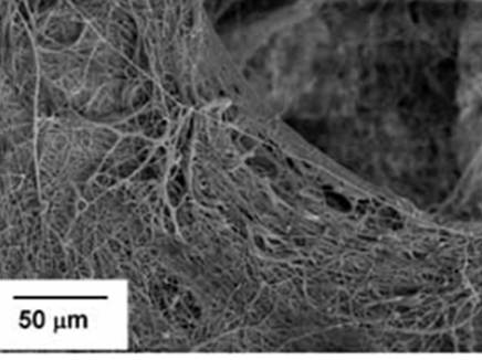 Electrospun structure resembling part of stromal lamella
