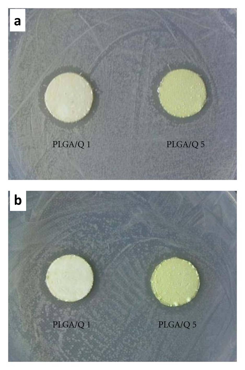 inhibition zone around nanofiber membrane